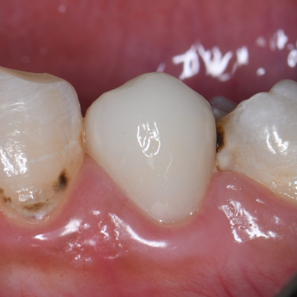 ADA7A3CA-7DFE-450A-9D86-28F2A7BC50FD