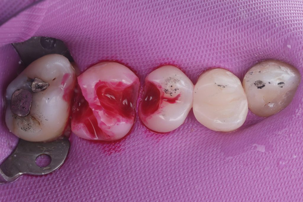 B4841274-ACC7-4CE0-AD0C-04CE99C6DCDE