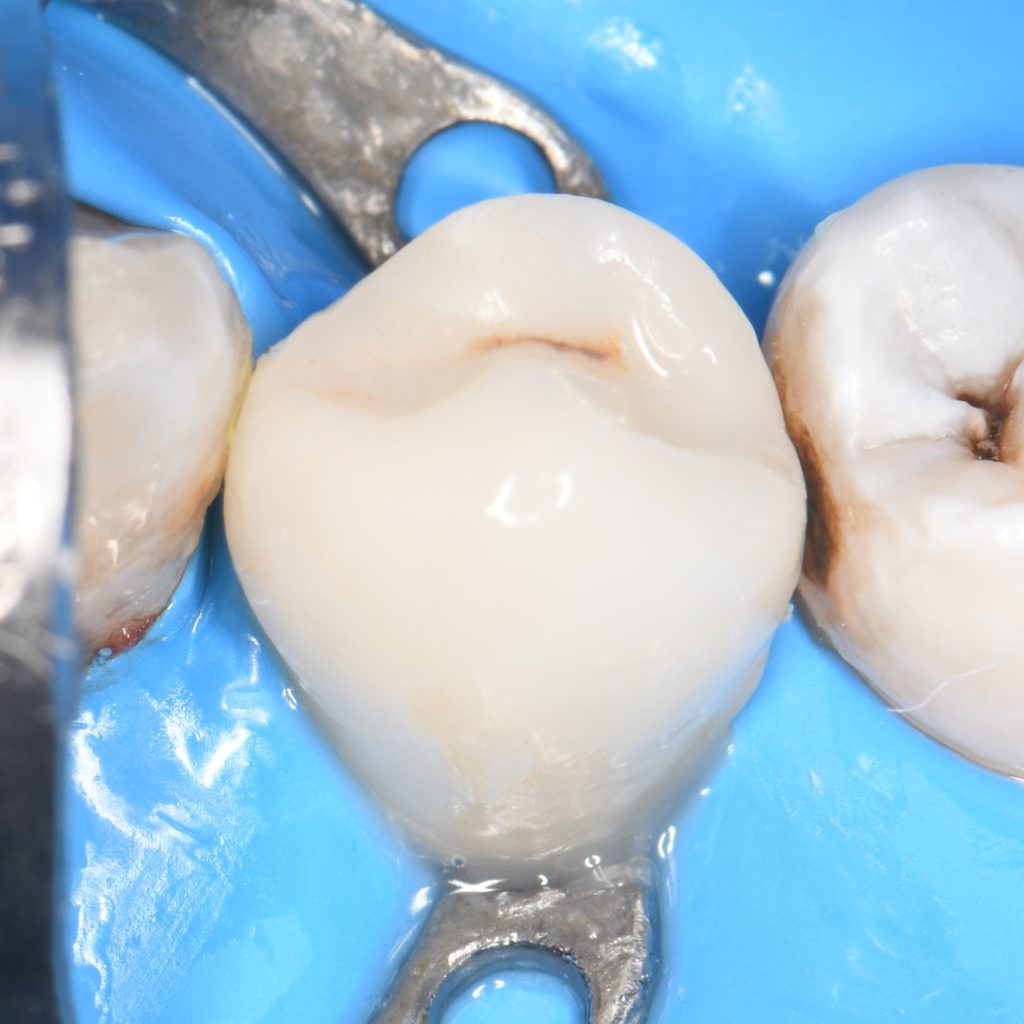 BEB1F92D-F828-4833-824A-6971FEC23CEE