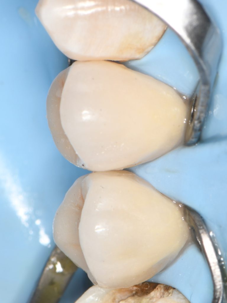 DE8511F2-C22D-4B37-AB9F-349B85047F23