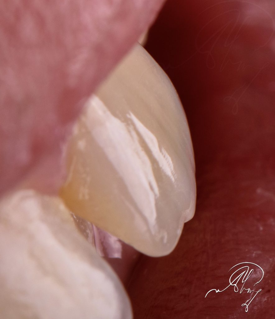 ECC5D35A-285C-492C-8CD4-96A08304AB7D