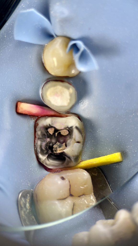 FBFBF5F9-4382-4B7E-8CE1-416691E839B6