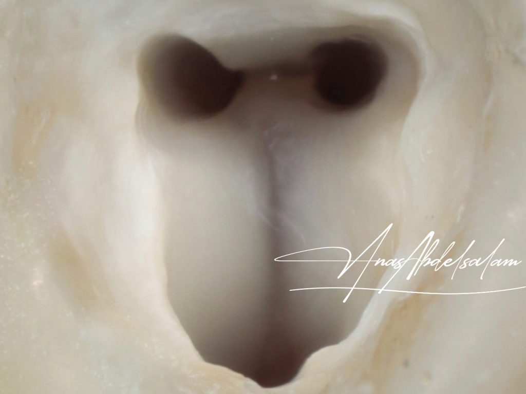 Picsart_25-01-02_12-30-21-371