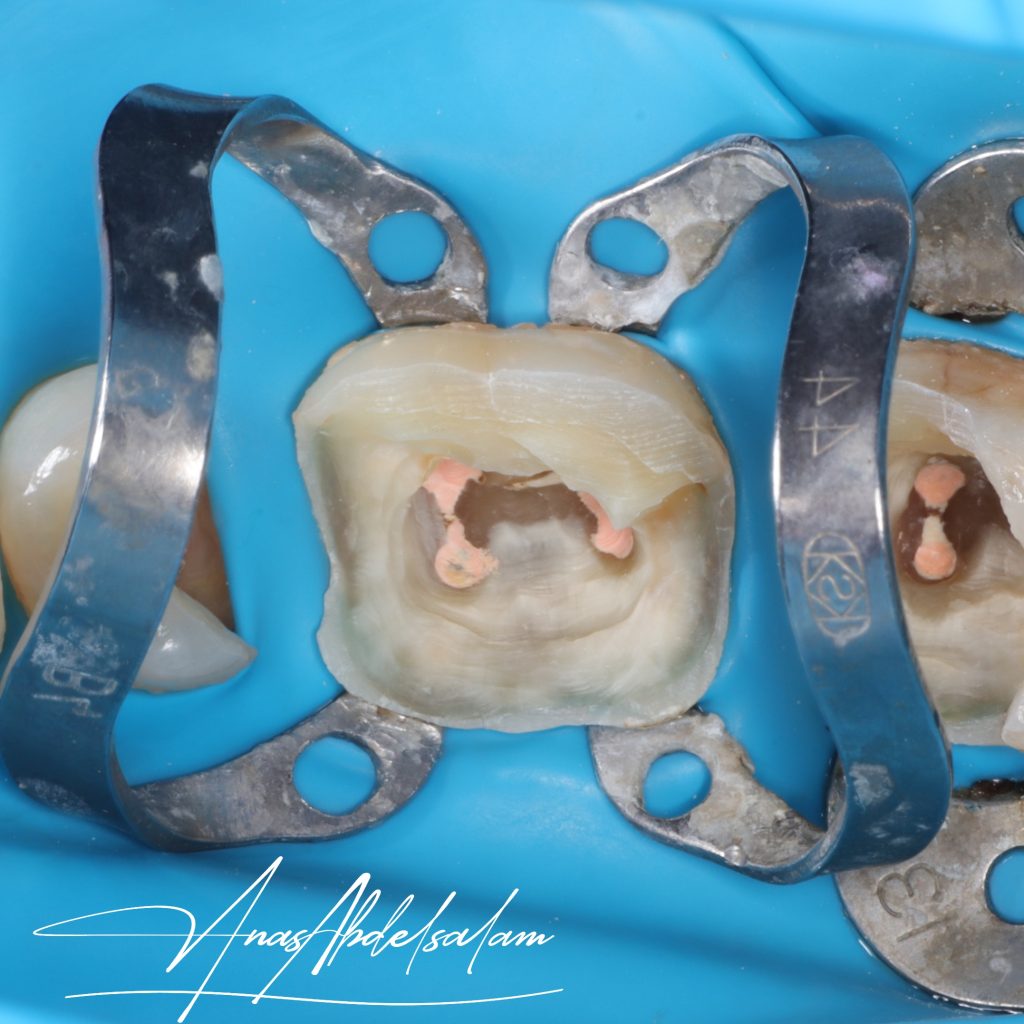 Picsart_25-01-12_21-46-33-460