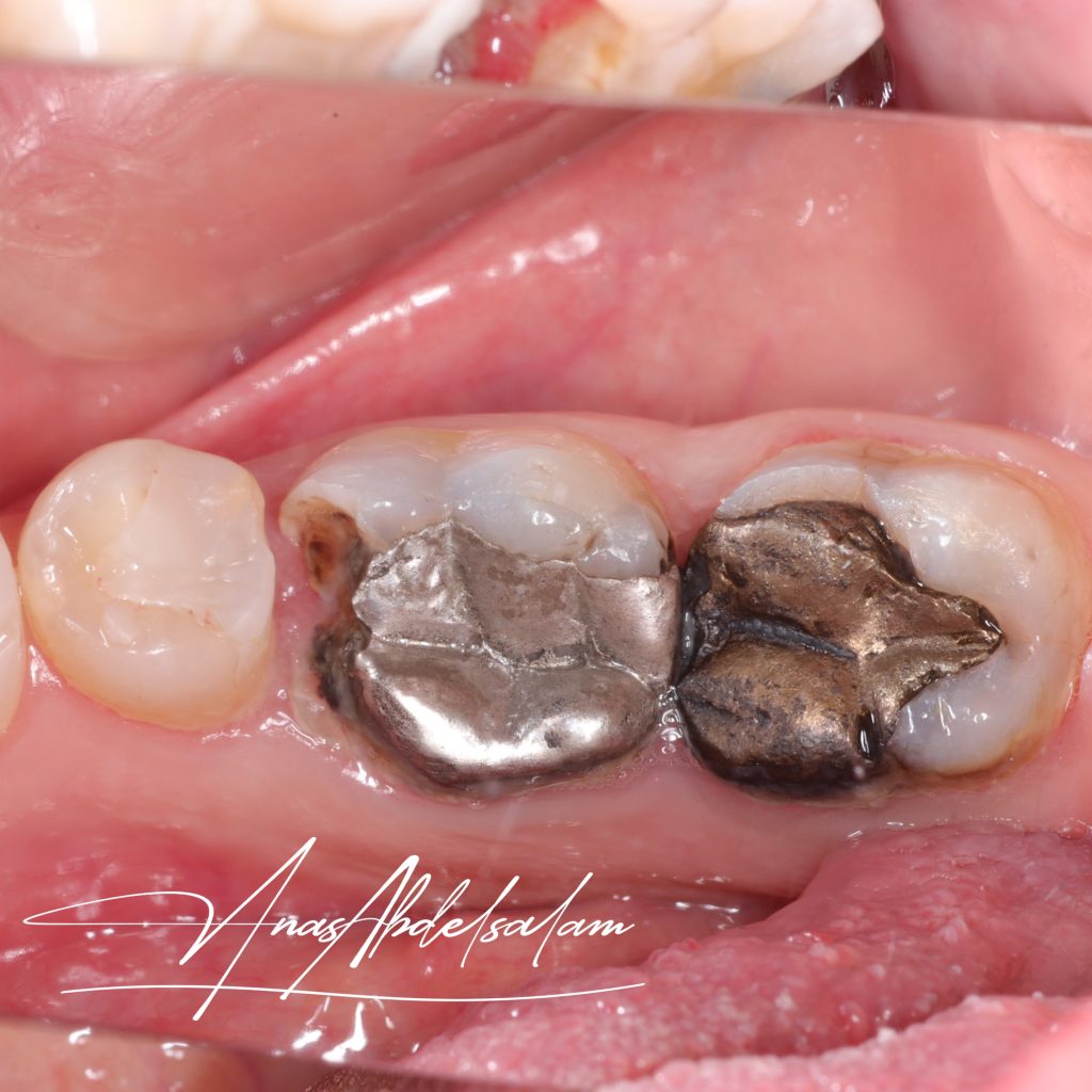 Picsart_25-01-27_18-05-16-443