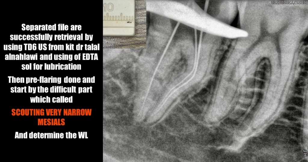 bc42a302-98f8-44c5-9cf5-e33490616613