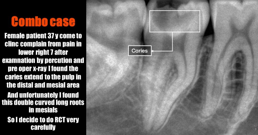 f1cf54cb-7304-4988-b1a1-f1f133be9ec8