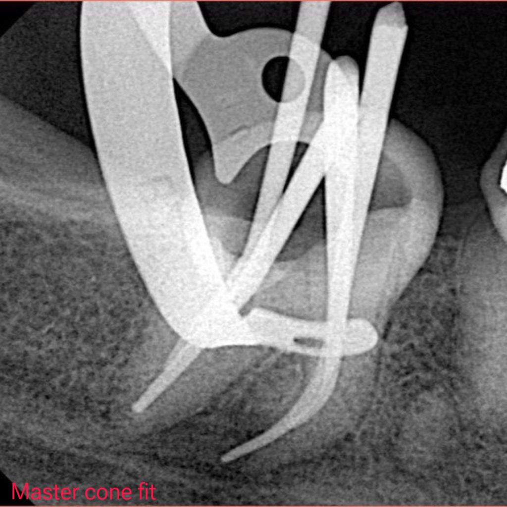 0D018C1D-700A-4701-8FA5-CB4BFF56783A