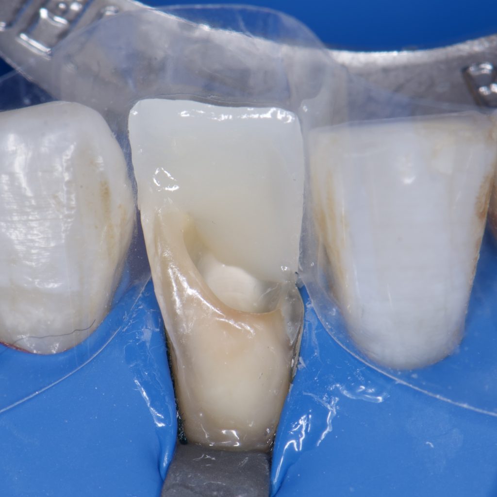 1DDF4774-E653-448F-B85E-8A302F110A6B