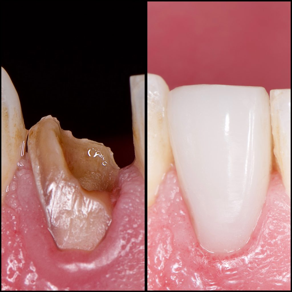 40587511-08C0-4C36-8EDD-25D469F4763D