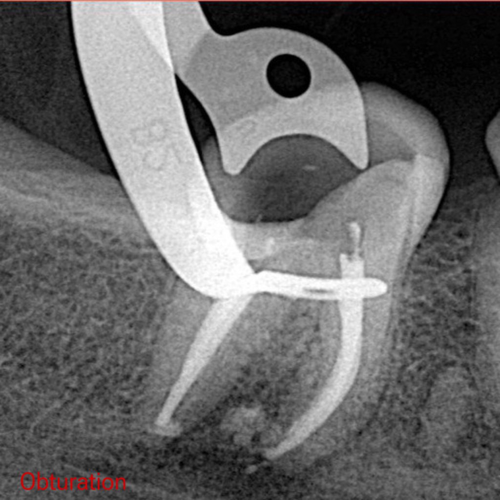 58D2FA75-5247-4A0D-B24D-7E4A49B91A0D