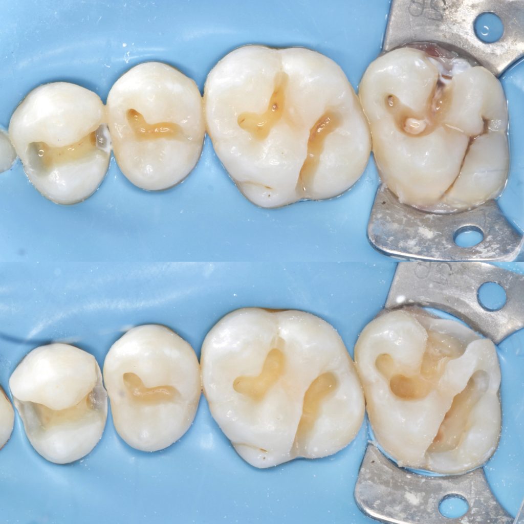 5DAA4D92-C4C2-44DF-867B-60A4AED8DE54