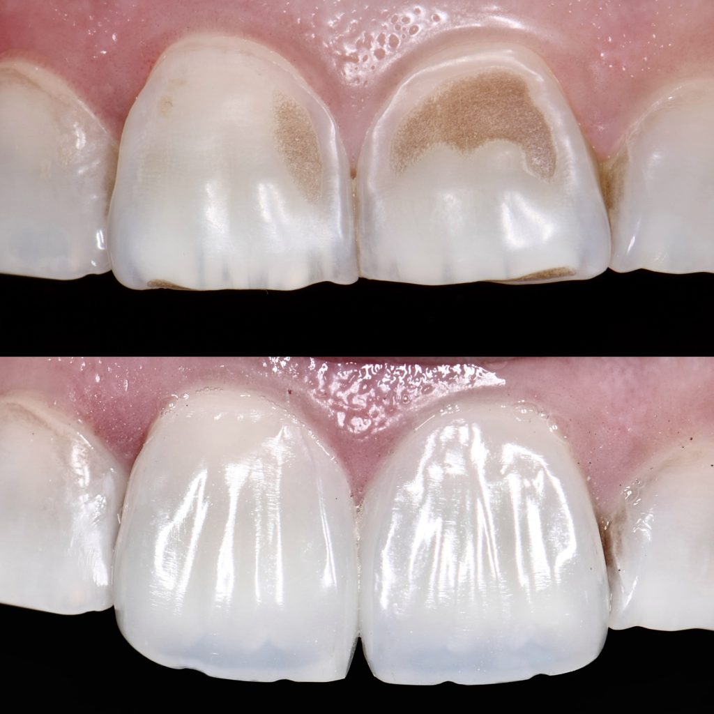 7F386BA9-5E4B-4DB5-B88C-2D0917C2CC31