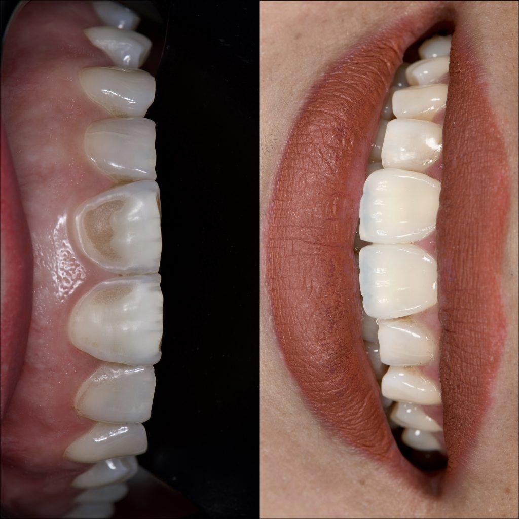 80736BF7-B7E0-402B-85E8-E1B58DA909D3