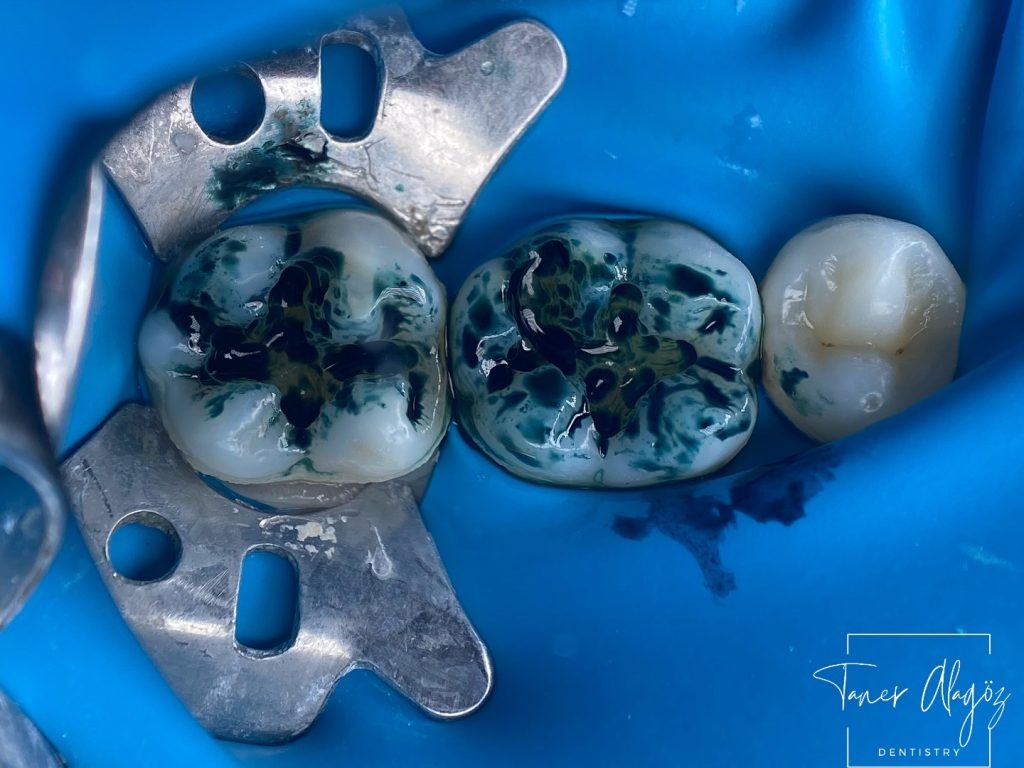 84DD97AD-E75C-46C2-BA32-EE5DBEFEB514