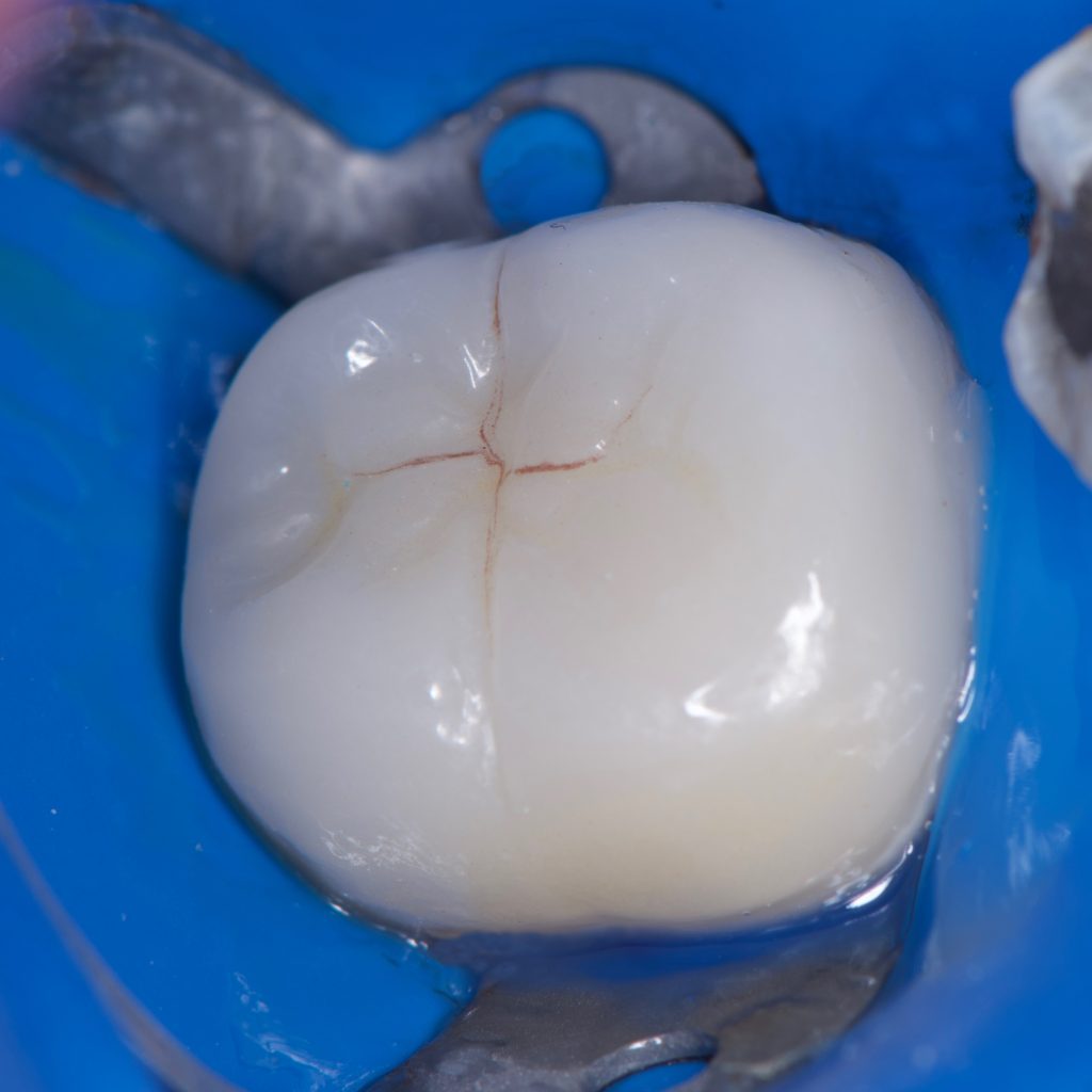 99A569E2-651D-441F-892C-4644234623E2