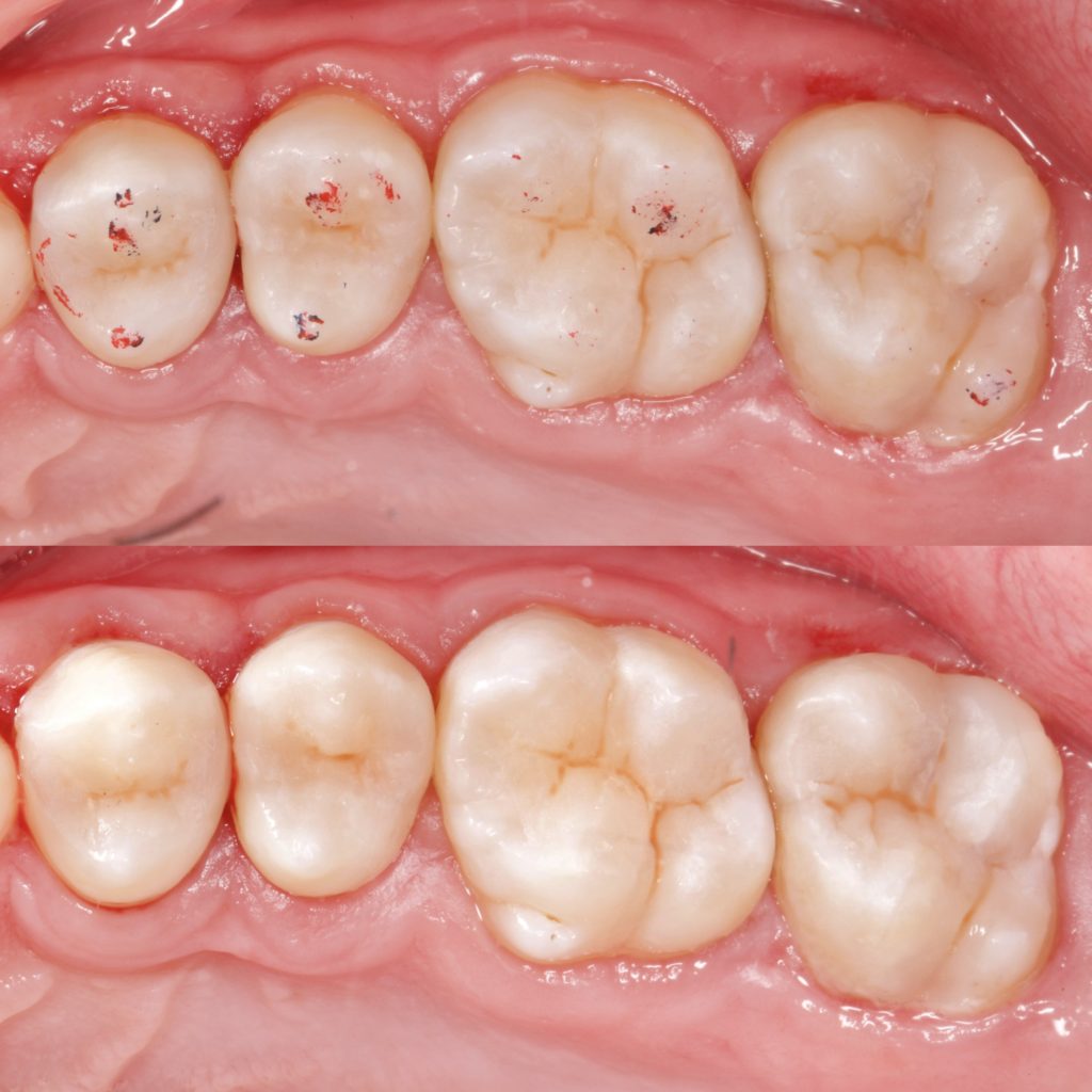 9D55950D-212E-43B7-8B4E-3ECFEF62EAC8