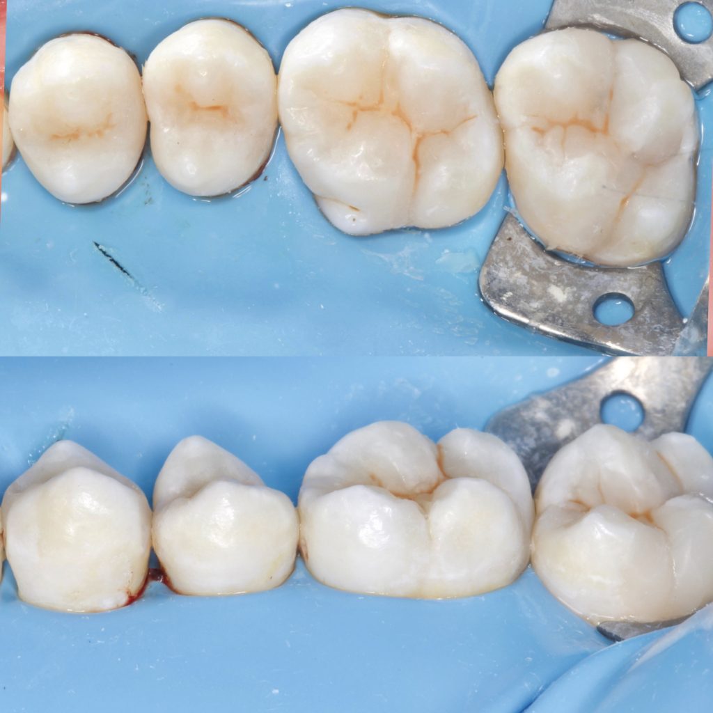 A87D6045-06E7-4BCD-93AA-BD606485CE30