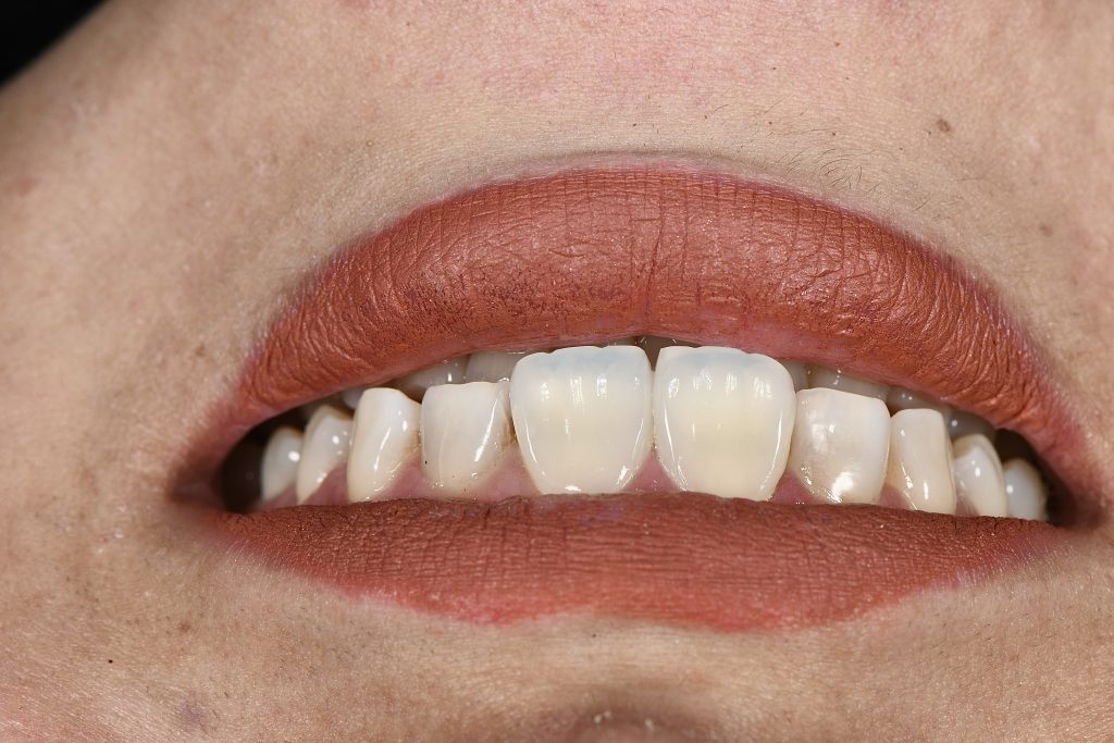 B581BC61-0A1E-4FB4-AA66-E780626ECC08