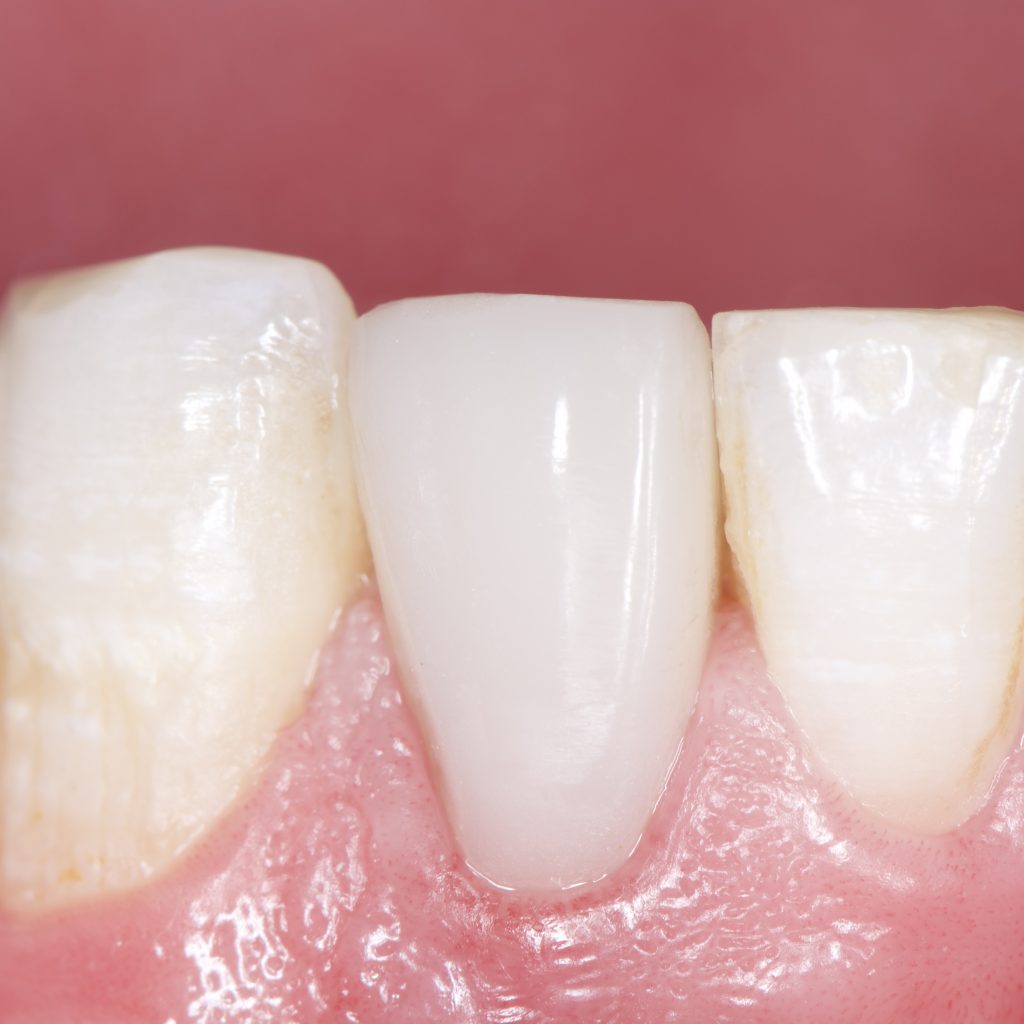 B7D7F0B6-F859-4B72-8638-EF25D1CD4E78