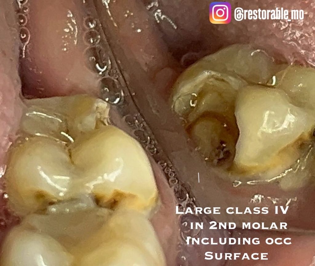 C1138689-4D6A-414B-80CE-C1B5A860EA5A