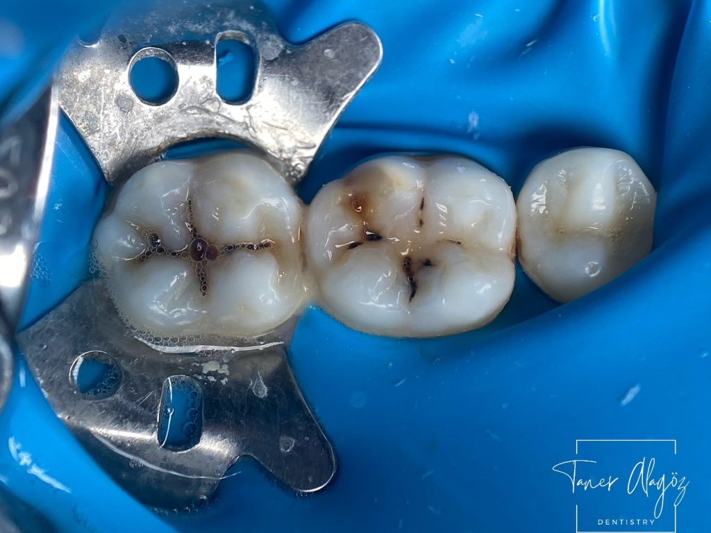 C8395FCB-3473-4549-9841-6A5072CFC83A