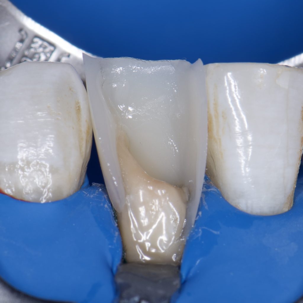 CB3005D4-2D94-411A-A869-F5532B090873