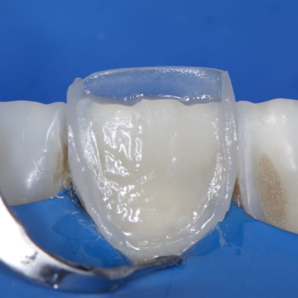 D7AE6E0E-58EF-4B9B-A2DB-C769CBCC52DD