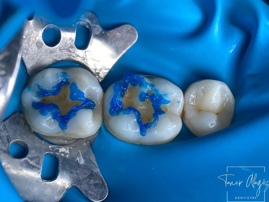 DE0F4C8D-4308-4AE9-BA5B-0594A05F04BF