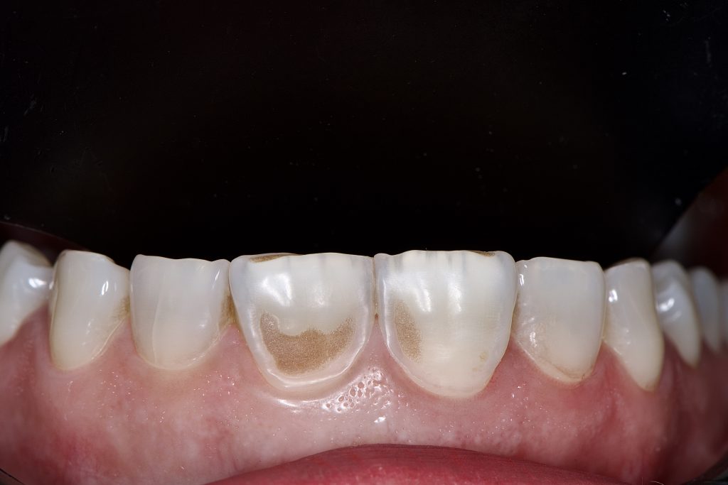 DF863EA1-C092-4D79-902B-CACFB97F52B8