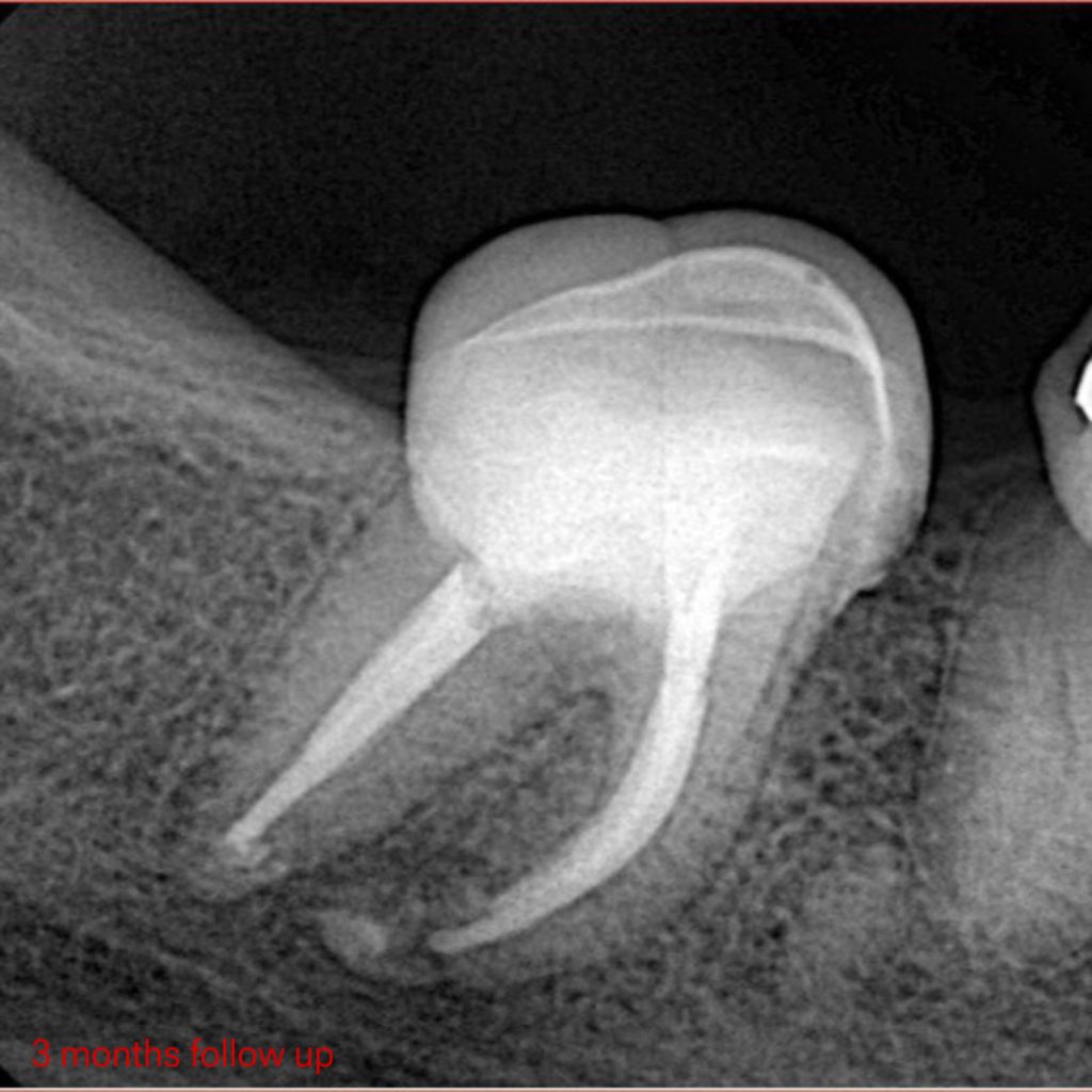 E4EED55B-1CCD-4328-952D-7526C03204AE