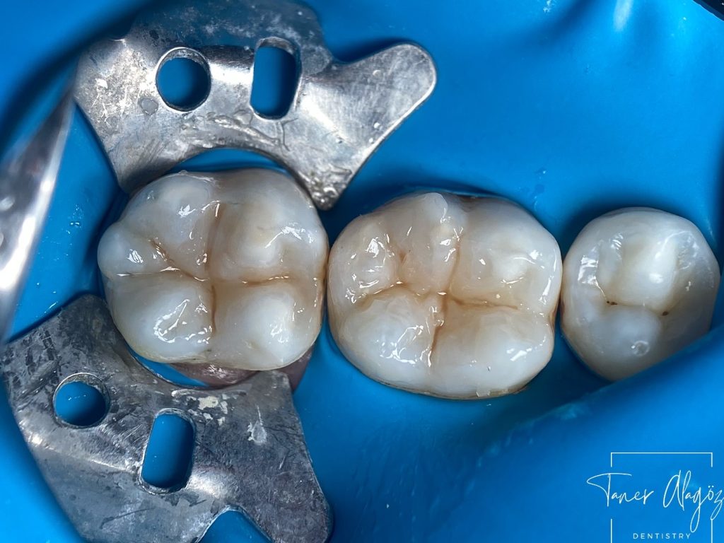 F7A32687-670C-44DE-AB7B-0445B34D127A