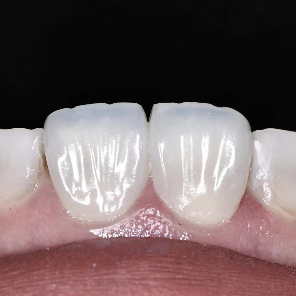 FC78E593-E879-4A0A-A175-A75495B3C9E6