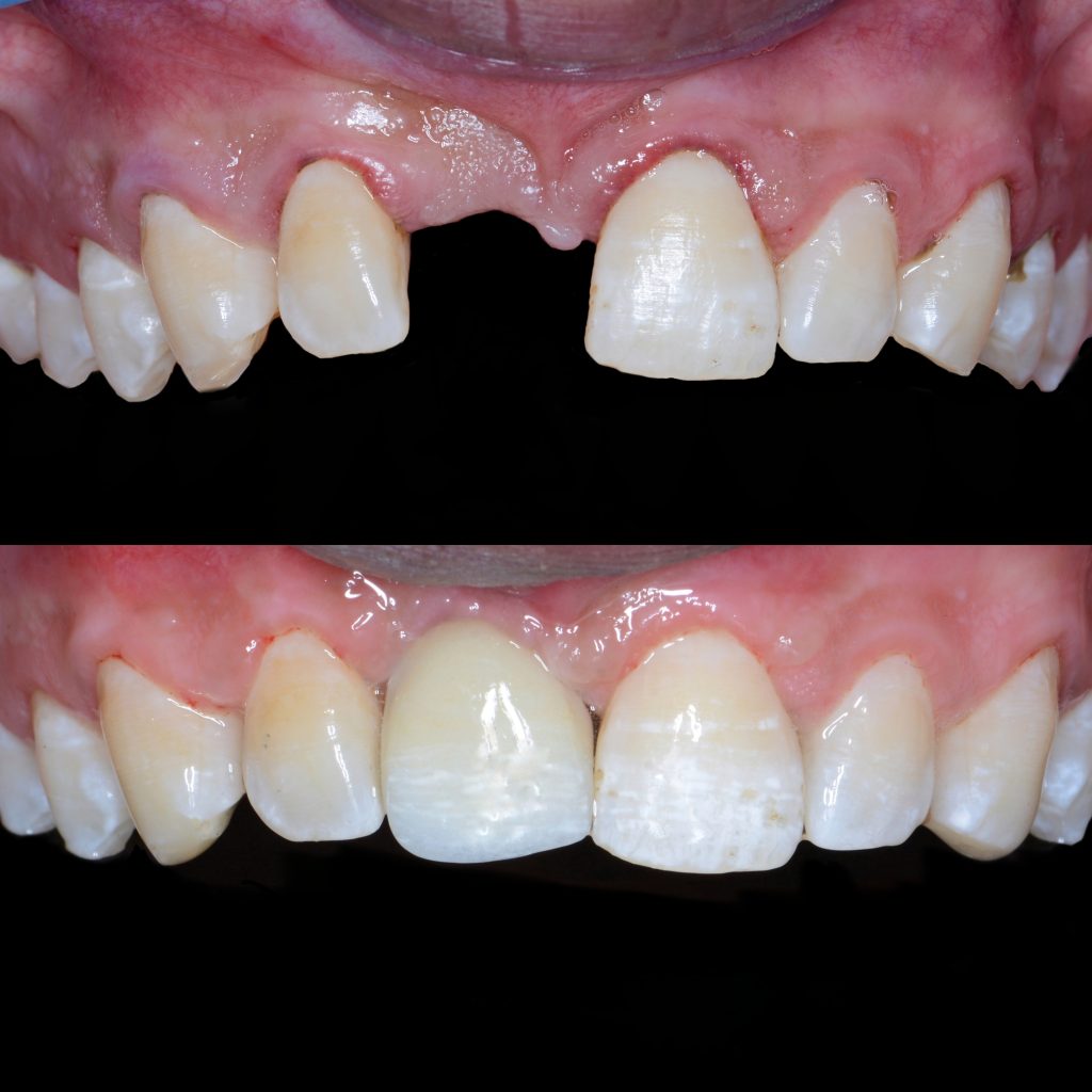 InCollage_20250117_021951535