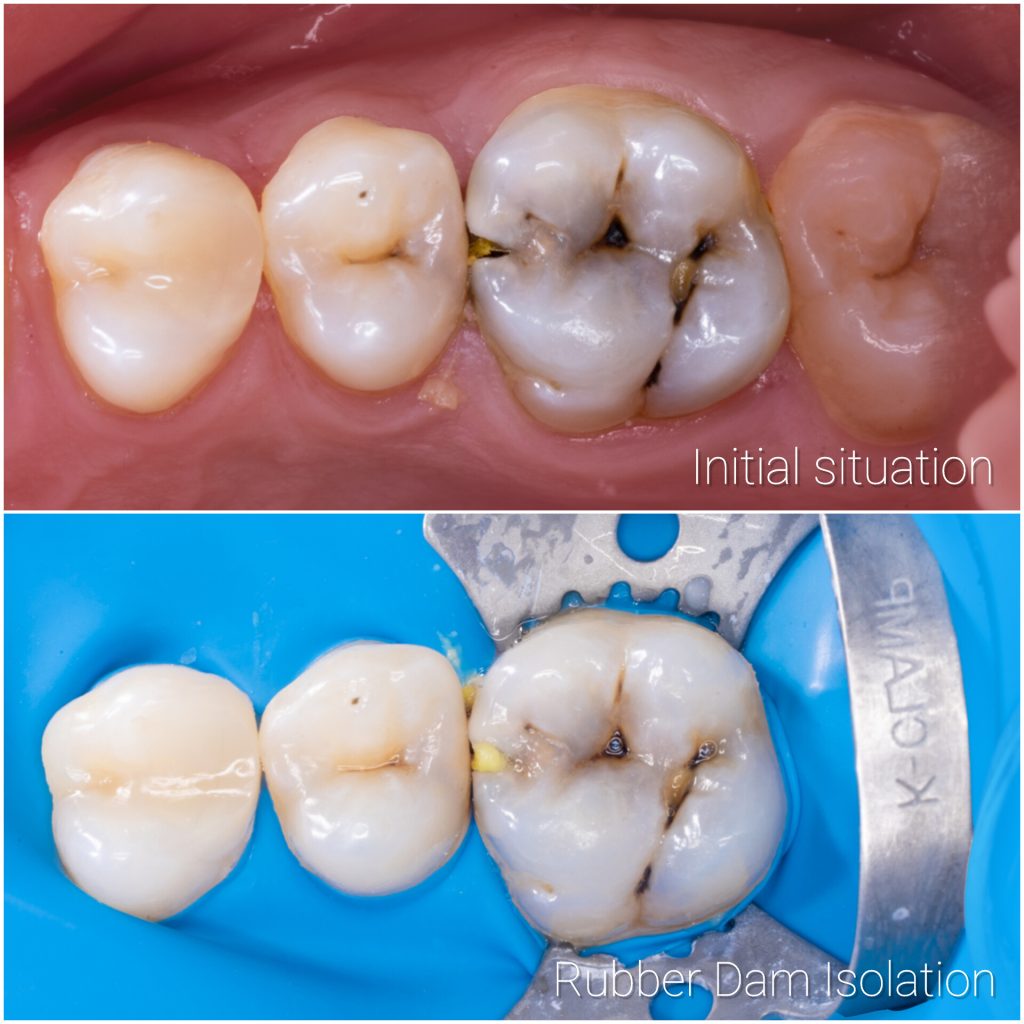 InShot_20241205_182720876