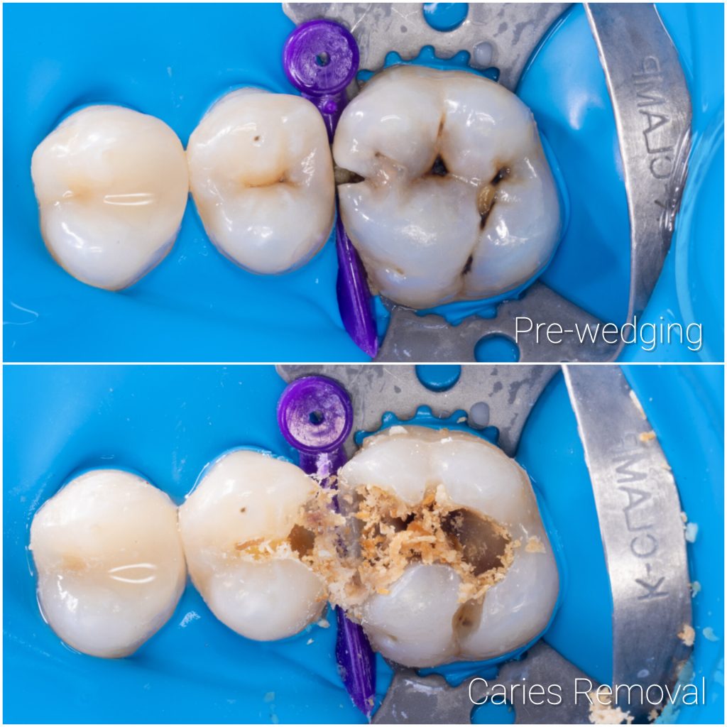 InShot_20241205_182931562