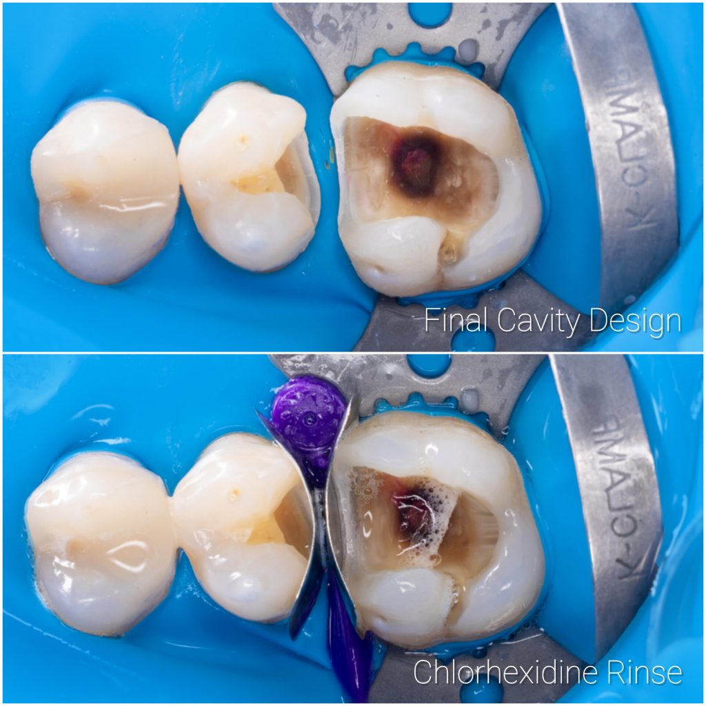 InShot_20241205_183123572