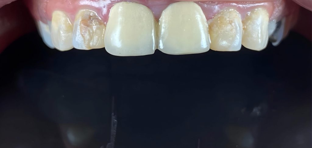 Picsart_25-02-02_19-43-13-021