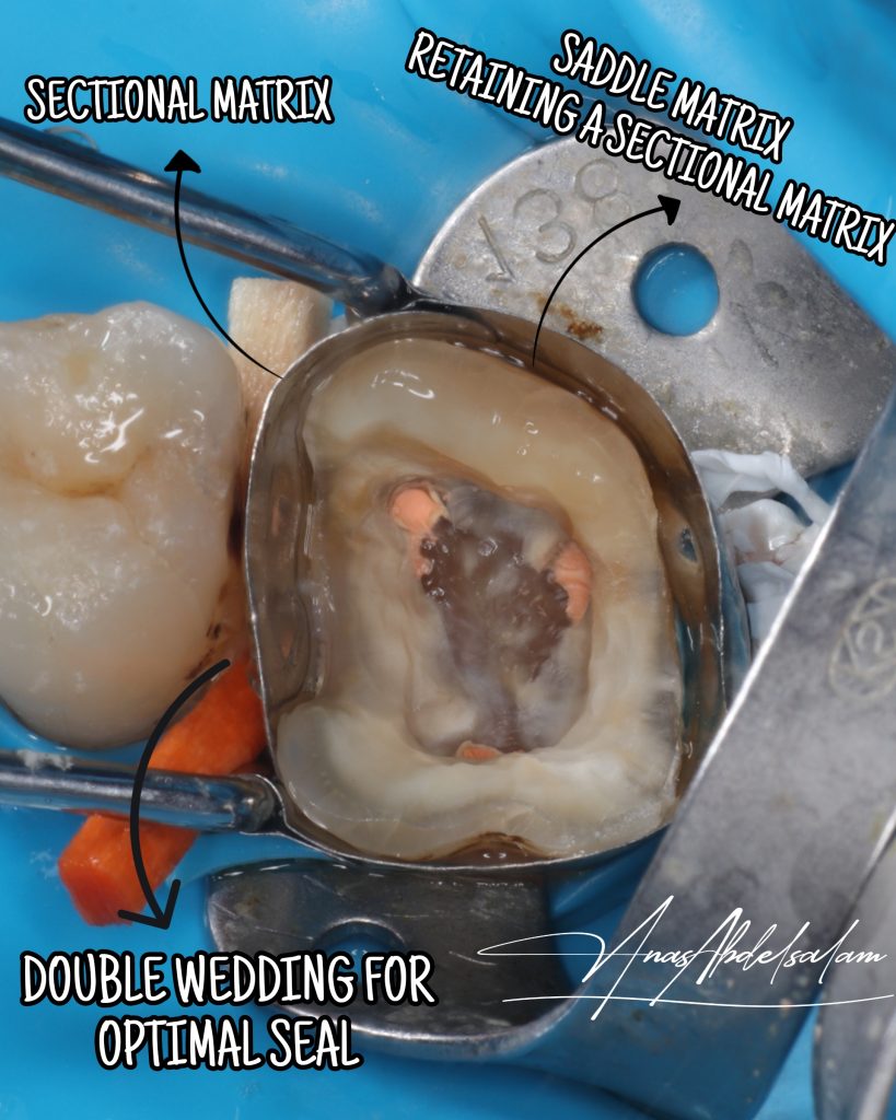 Picsart_25-02-16_00-41-08-021