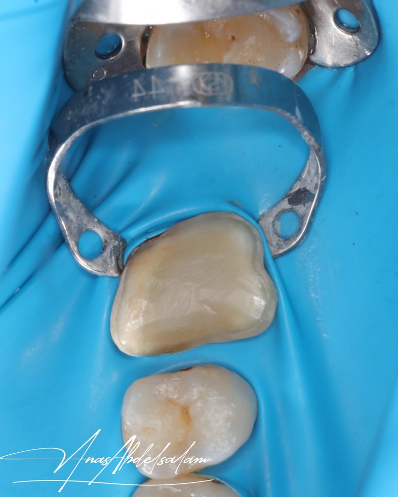 Picsart_25-02-16_00-45-25-189