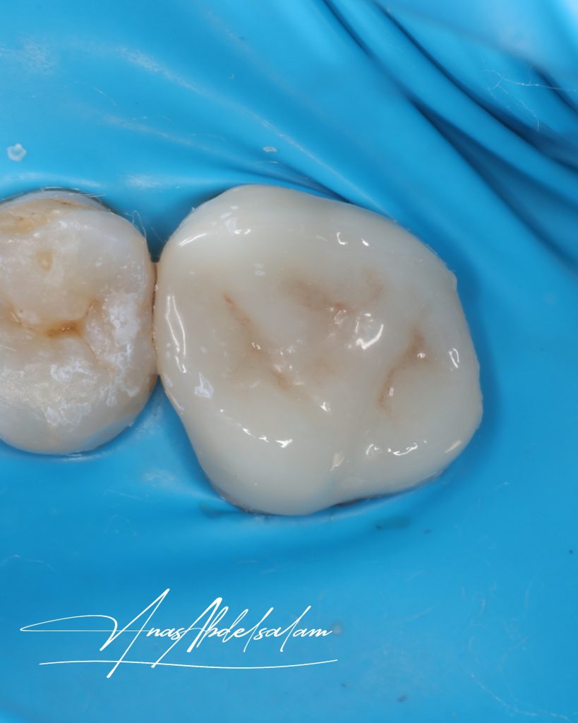 Picsart_25-02-16_01-01-24-873