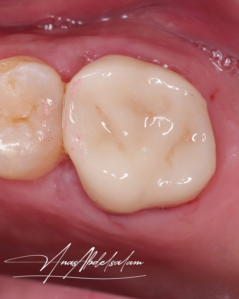 Picsart_25-02-16_01-02-23-643