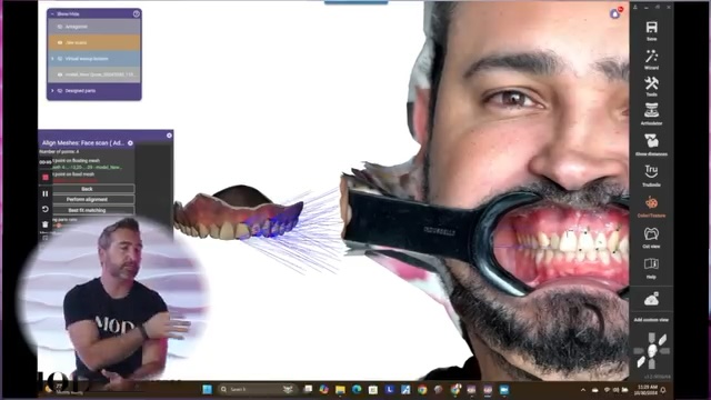 Qlone Dental alignement in exocad