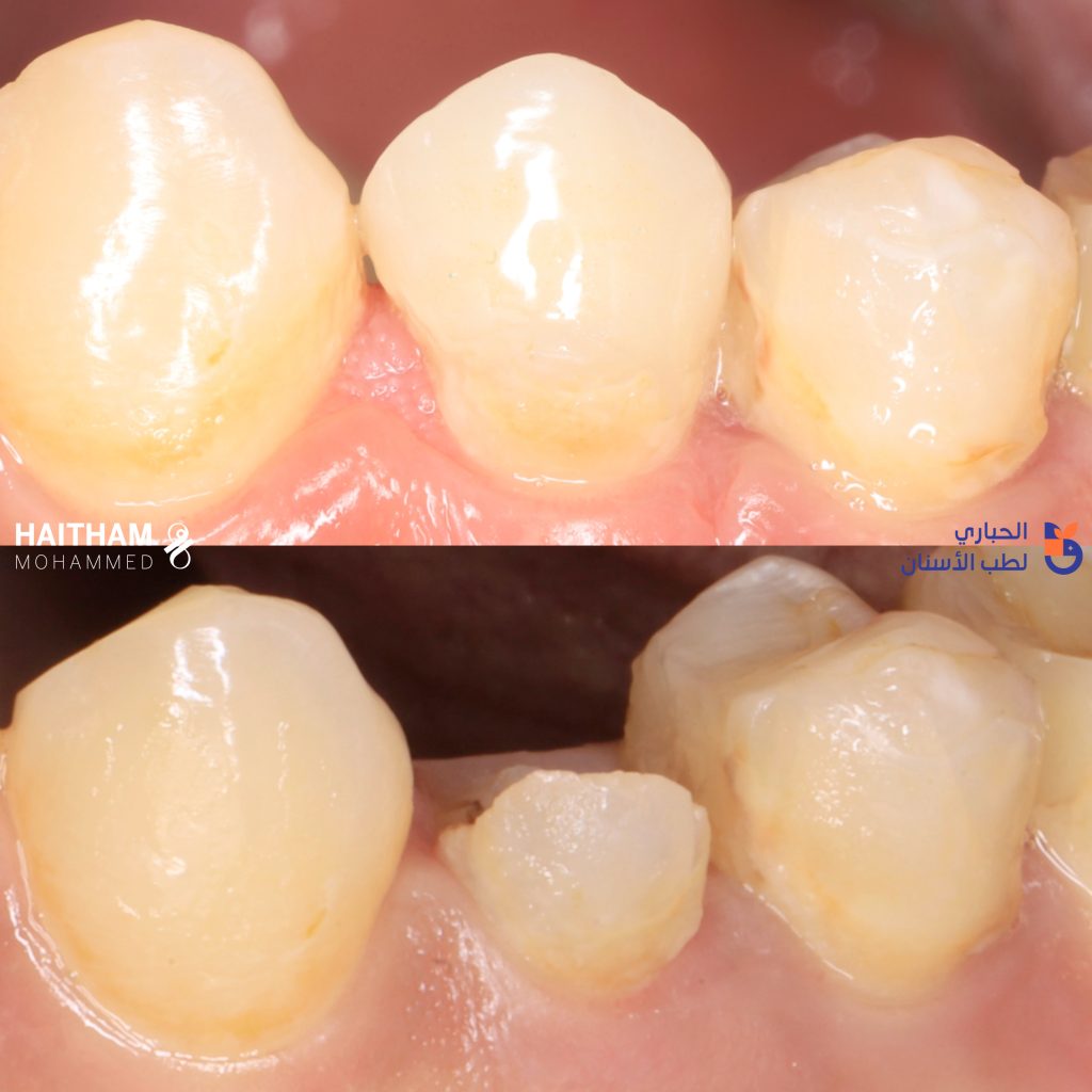 01AB407D-E8F1-4B04-BFBA-97E546B33E6D