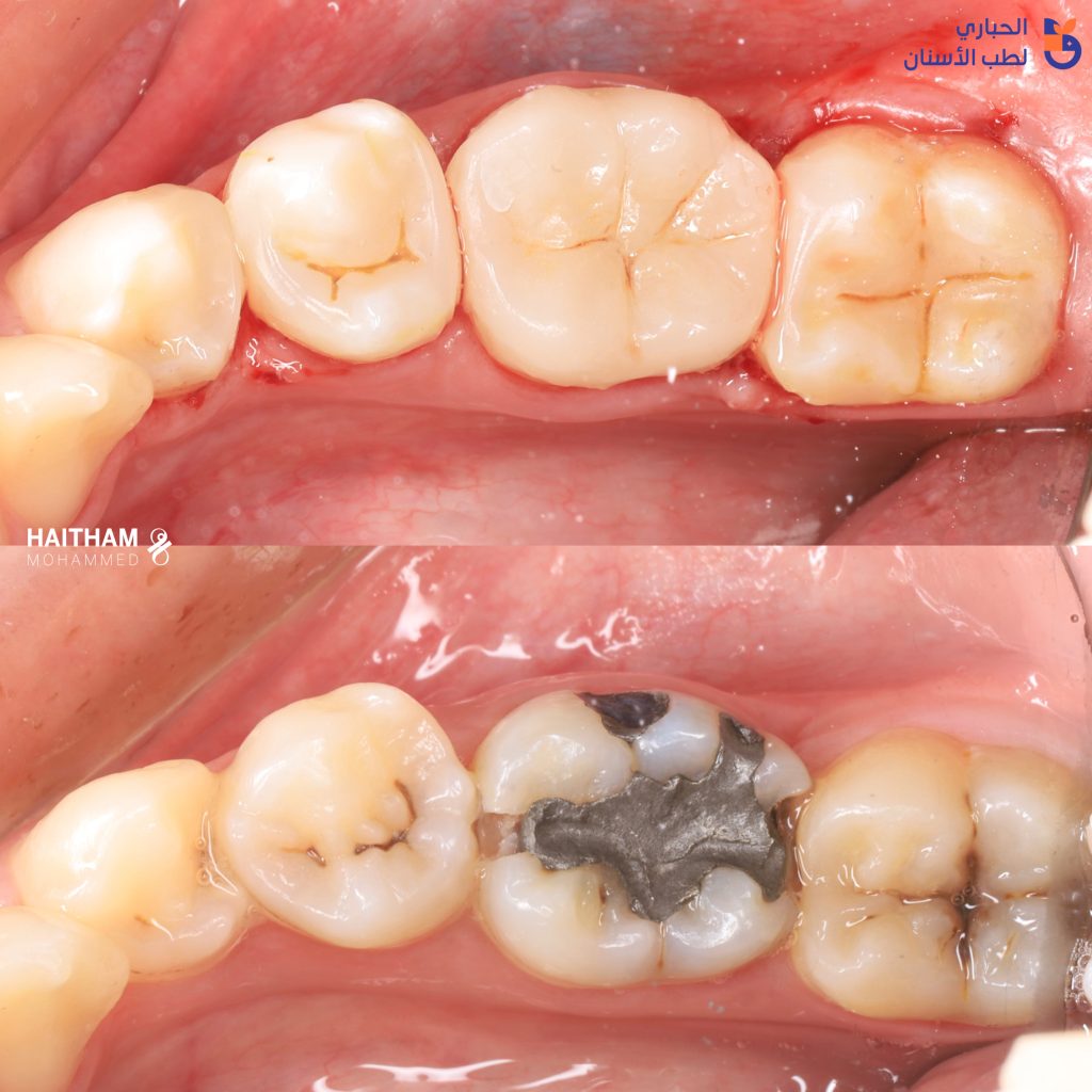 1D364A56-4122-4C0B-BCB2-A9A52FEF80F6