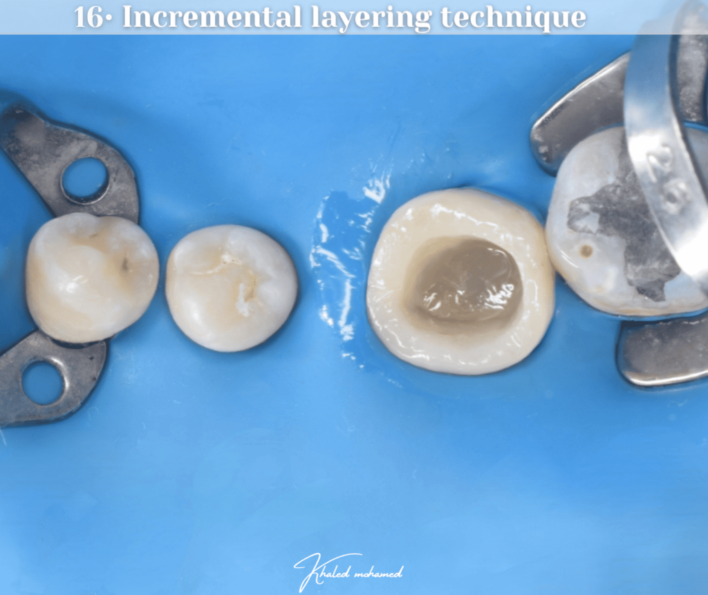 Horizontal layering technique - Incremental build up