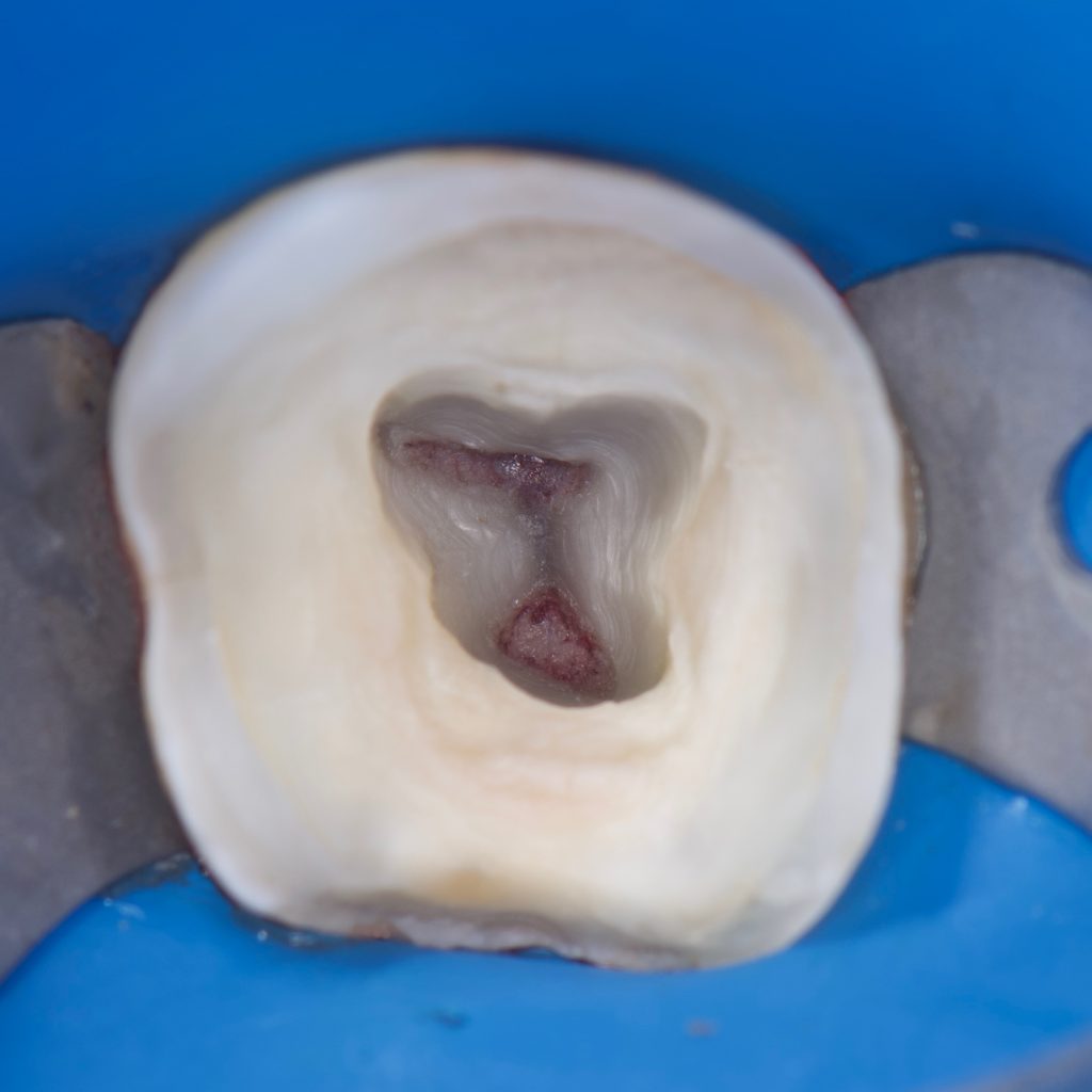 2AC2692D-B138-4987-A95D-4CBD47476279