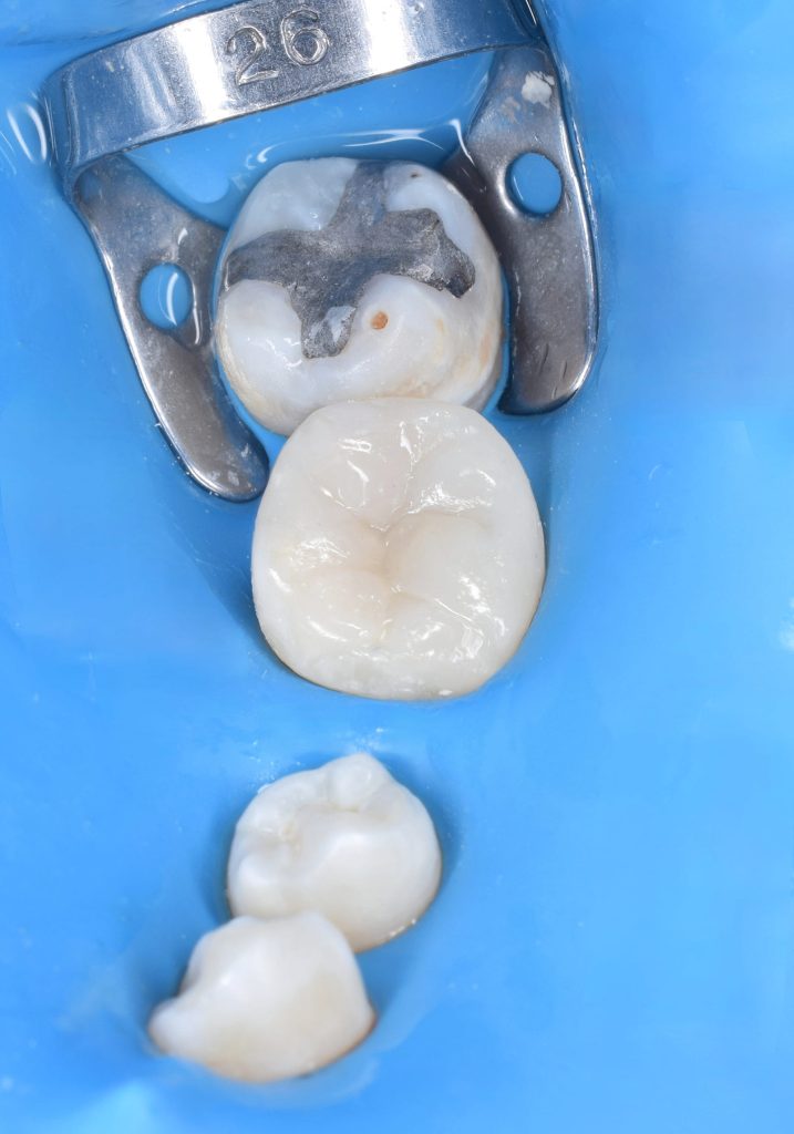 Direct shot after polishing