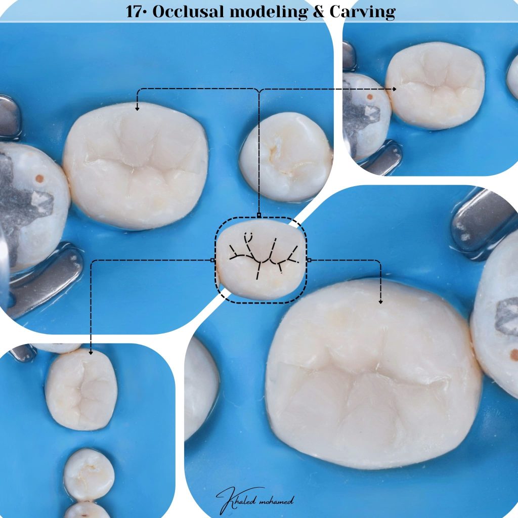 Occlusal modeling - carving