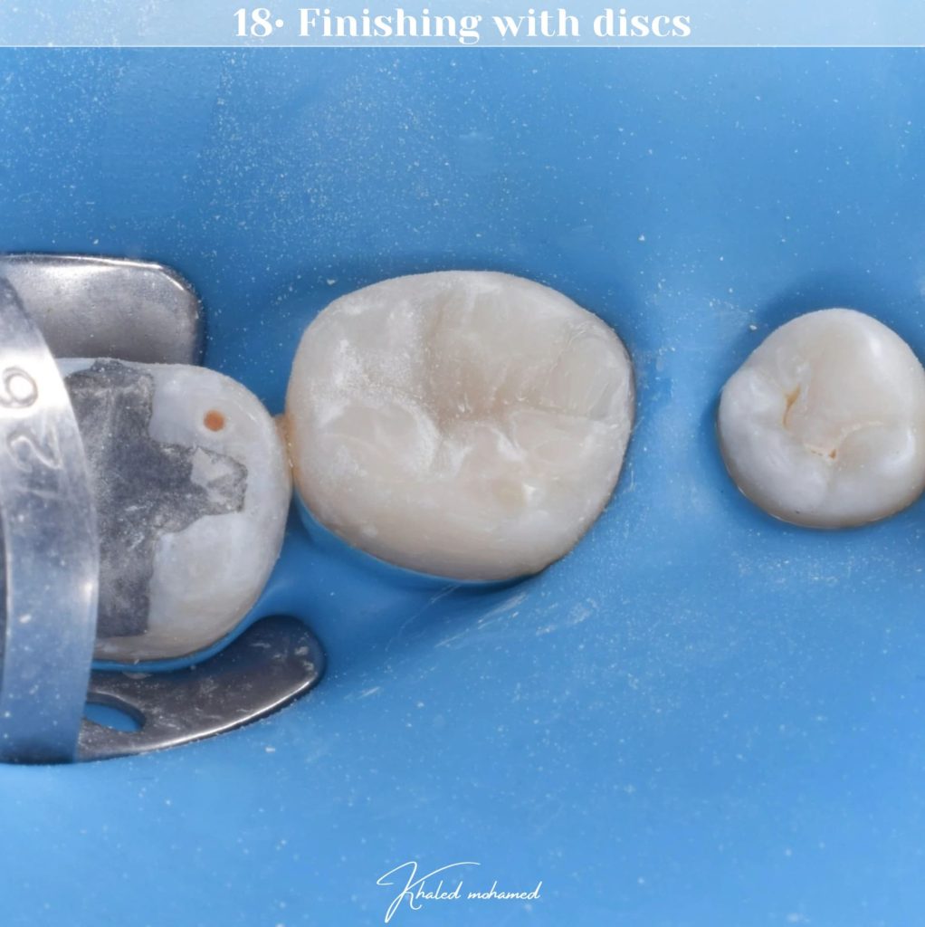 Finishing with discs